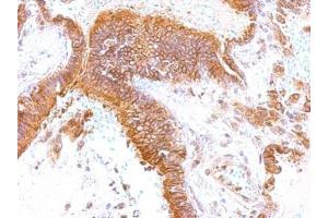 IHC-P Image GEM antibody [N1], N-term detects GEM protein at membrane on human lung by immunohistochemical analysis. (GEM antibody  (N-Term))