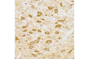 Immunohistochemistry of paraffin-embedded mouse brain using DENN Rabbit mAb (ABIN7268396) at dilution of 1:50 (40x lens). (MADD antibody)