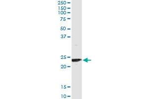 Immunoprecipitation of UBE2T transfected lysate using anti-UBE2T monoclonal antibody and Protein A Magnetic Bead , and immunoblotted with UBE2T MaxPab rabbit polyclonal antibody. (Ube2t antibody  (AA 1-197))