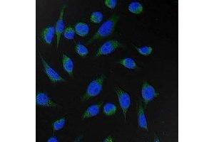 Immunofluorescent analysis of Fumarase staining in Hela cells. (FH antibody)