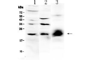 Western blot analysis of IL-22 using anti-IL-22 antibody . (IL-22 antibody  (AA 34-179))