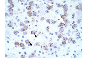 CATSPER2 antibody was used for immunohistochemistry at a concentration of 4-8 ug/ml to stain Neural cells (arrows) in Human Brain. (CATSPER2 antibody  (N-Term))