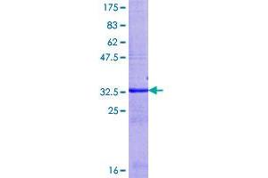 UGT2B15 Protein (AA 85-160) (GST tag)