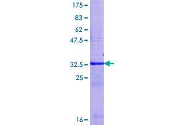 UGT2B15 Protein (AA 85-160) (GST tag)