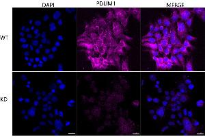 Immunocytochemical staining of HeLa cells using PDLIM1 antibody (ABIN7799748), 1:1,000), Top panel: wild-type (WT), Bottom panal: PDLIM1 shRNA knockdown (KD).