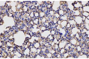 Immunohistochemistry (Paraffin-embedded Sections) (IHC (p)) image for anti-Annexin A5 (ANXA5) antibody (ABIN7234522)