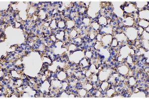 Immunohistochemistry of paraffin-embedded Mouse lung using ANXA5 Polycloanl Antibody at dilution of 1:150 (Annexin V antibody)