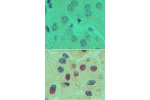 Image no. 1 for anti-One Cut Homeobox 1 (ONECUT1) (AA 420-470) antibody (ABIN960298) (ONECUT1 antibody  (AA 420-470))