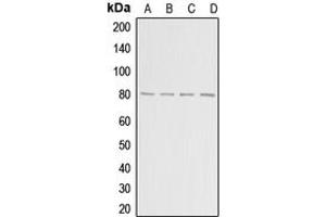 Western blot analysis of ADAR2 expression in HepG2 (A), MCF7 (B), mouse brain (C), rat brain (D) whole cell lysates. (RED1 antibody  (Center))