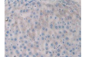 Used in DAB staining on fromalin fixed paraffin- embedded kidney tissue (FLT1 antibody  (AA 303-524))