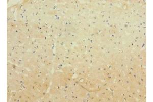 Immunohistochemistry of paraffin-embedded human heart tissue using ABIN7163876 at dilution of 1:100 (WBSCR17 antibody  (AA 101-300))