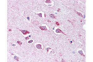 Anti-TLL2 antibody IHC of human brain, neurons and glia. (Tolloid-Like 2 antibody  (CUB2 Domain))