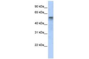 Image no. 1 for anti-Interferon Regulatory Factor 6 (IRF6) (AA 395-444) antibody (ABIN6742300) (IRF6 antibody  (AA 395-444))