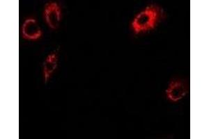 Immunofluorescent analysis of Tropomodulin-4 staining in U2OS cells. (Tropomodulin 4 antibody)