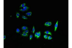 Immunofluorescent analysis of HepG2 cells using ABIN7159332 at dilution of 1:100 and Alexa Fluor 488-congugated AffiniPure Goat Anti-Rabbit IgG(H+L)