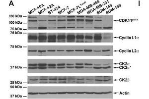 Expression of CDK11 and CK2 protein complex members in untransformed and malignant breast cells. (Cyclin L2 antibody  (AA 309-384))