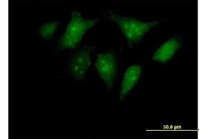 Immunofluorescence of purified MaxPab antibody to RBED1 on HeLa cell. (ELMOD3 antibody  (AA 1-391))