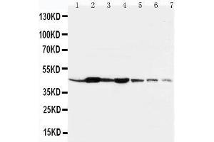 Lane 1: Rat Liver Tissue LysateLane 2: Rat Spleen Tissue LysateLane 3: Rat Brain Tissue LysateLane 4: Rat Kidney Tissue LysateLane 5: HELA Cell LysateLane 6: SMMC Cell LysateLane 7: SGC Cell Lysate (beta Actin antibody  (N-Term))