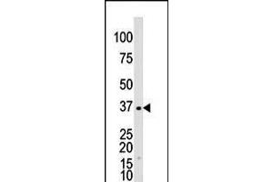 Antibody is used in Western blot to detect GALK1 in Y79 cell lysate. (GALK1 antibody  (C-Term))