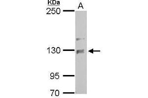 WB Image NCKAP1 antibody [C1C2], Internal detects NCKAP1 protein by Western blot analysis. (NCKAP1 antibody)