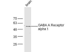 Mouse brain lysates probed with Rabbit Anti-GABA A Receptor alpha 1 Polyclonal Antibody, Unconjugated  at 1:500 for 90 min at 37˚C. (GABRA1 antibody  (AA 301-450))