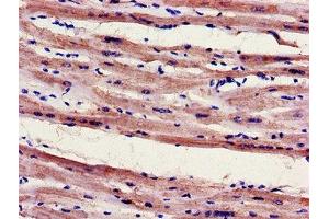 Immunohistochemistry of paraffin-embedded human heart tissue using ABIN7152948 at dilution of 1:100 (FILIP1 antibody  (AA 957-1192))