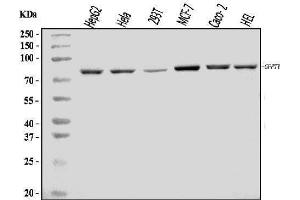 Western blot analysis of GFPT1 using anti-GFPT1 antibody (ABIN7602887).