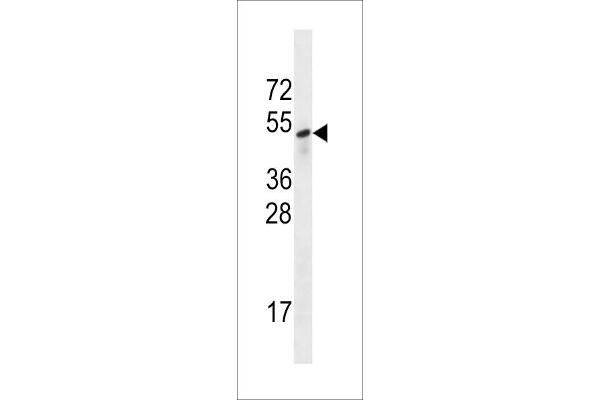 SESN3 Antikörper  (AA 320-347)