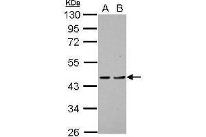 WB Image Sample (30 ug of whole cell lysate) A: H1299 B: HCT116 10% SDS PAGE antibody diluted at 1:1000 (PDCD2 antibody)