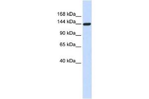 DAAM1 antibody used at 1 ug/ml to detect target protein.