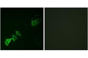 Immunofluorescence analysis of A549 cells, using Abl (Phospho-Tyr393/412) Antibody. (ABL1 antibody  (pTyr393))