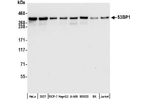 Western Blotting (WB) image for anti-Tumor Protein P53 Binding Protein 1 (TP53BP1) (AA 350-400) antibody (ABIN7455070) (Recombinant TP53BP1 antibody  (AA 350-400))
