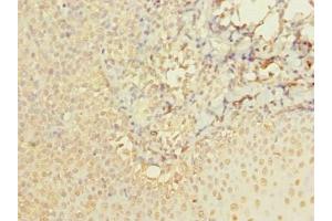 Immunohistochemistry of paraffin-embedded human tonsil tissue using ABIN7142924 at dilution of 1:100 (ABI3 antibody  (AA 1-366))