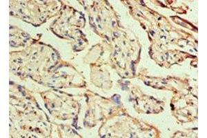 Immunohistochemistry of paraffin-embedded human placenta tissue using ABIN7155678 at dilution of 1:100 (DLX3 antibody  (AA 1-120))