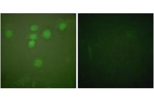 Immunofluorescence analysis of HeLa cells, using CREB (Ab-142) Antibody. (CREB1 antibody  (AA 111-160))