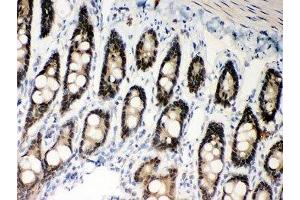 IHC-P: MSH2 antibody testing of rat intestine tissue (MSH2 antibody  (AA 337-583))