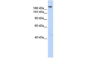 DYSF antibody used at 1 ug/ml to detect target protein. (Dysferlin antibody)