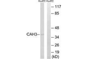 Western blot analysis of extracts from HuvEc cells, using CA3 Antibody.