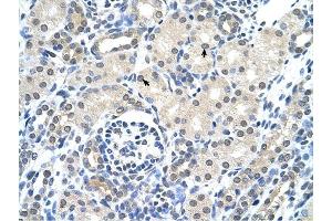 Cytokeratin 17 antibody was used for immunohistochemistry at a concentration of 4-8 ug/ml to stain Epithelial cells of renal tubule (arrows) in Human Kidney. (KRT17 antibody  (C-Term))