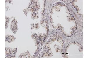 Immunoperoxidase of purified MaxPab antibody to ChGn on formalin-fixed paraffin-embedded human prostate. (CSGALNACT1 antibody  (AA 1-297))