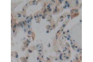 Figure. (Calmodulin 1 antibody  (AA 1-149))