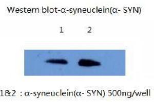 Western Blotting (WB) image for anti-Synuclein, alpha (SNCA) (AA 1-140) antibody (ABIN1105341) (SNCA antibody  (AA 1-140))
