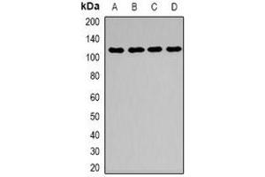 Western blot analysis of Desmoglein 1 expression in HEK293T (A), mouse kidney (B), mouse brain (C), mouse lung (D) whole cell lysates.