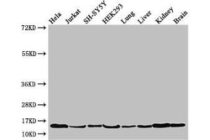 Western Blot Positive WB detected in: Hela whole cell lysate, Jurkat whole cell lysate, SH-SY5Y whole cell lysate, HEK293 whole cell lysate, Mouse lung tissue, Mouse liver tissue, Mouse kidney tissue, Mouse brain tissue All lanes: PAIP2 antibody at 3. (PAIP2 antibody  (AA 1-127))