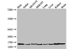 Western Blot Positive WB detected in: Hela whole cell lysate, Jurkat whole cell lysate, SH-SY5Y whole cell lysate, HEK293 whole cell lysate, Mouse lung tissue, Mouse liver tissue, Mouse kidney tissue, Mouse brain tissue All lanes: PAIP2 antibody at 3.
