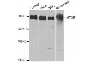 Western blot analysis of extracts of various cell lines, using MTOR antibody. (MTOR antibody  (AA 2388-2487))