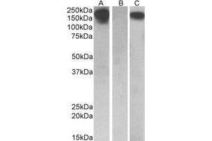 HEK293 lysate (10ug protein in RIPA buffer) overexpressing Human CSF1R with C-terminal MYC tag probed with AP22413PU-N(0. (CSF1R antibody  (Internal Region))