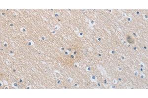 Immunohistochemistry of paraffin-embedded Human brain using SLC16A7 Polyclonal Antibody at dilution of 1:30