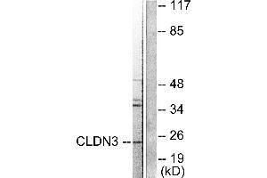 Western blot analysis of extracts from HuvEc cells, using Claudin 3 antibody. (Claudin 3 antibody)