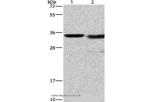 Western blot analysis of Mouse kidney tissue and A172 cell, using CTSL Polyclonal Antibody at dilution of 1:900 (Cathepsin L antibody)